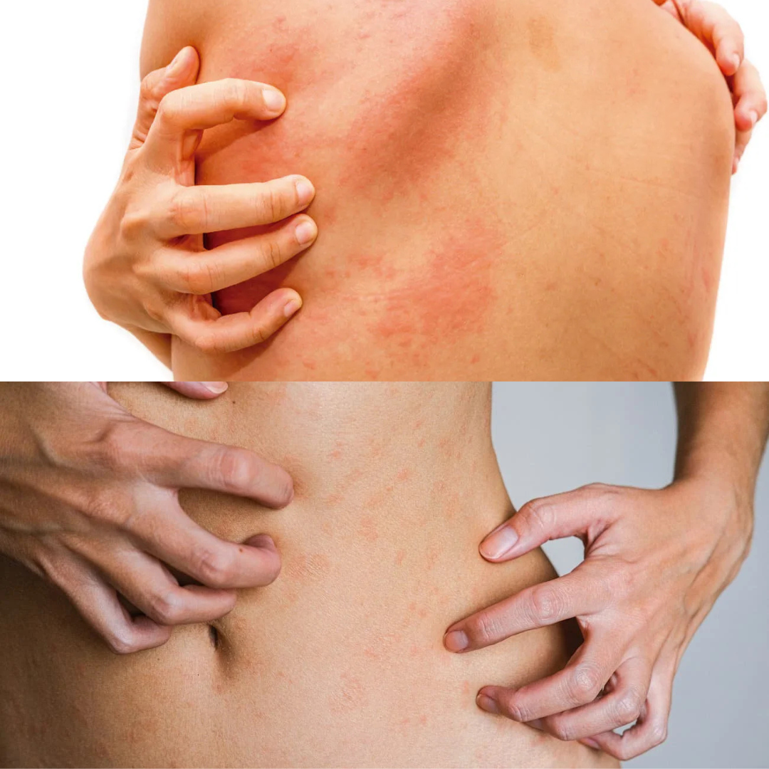 JABÓN LÍQUIDO ANTIMICÓTICO