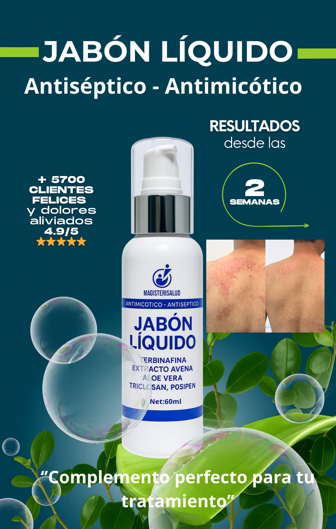 JABÓN LÍQUIDO ANTIMICÓTICO