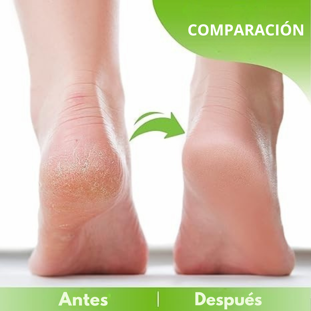 JABÓN LÍQUIDO ANTIMICÓTICO